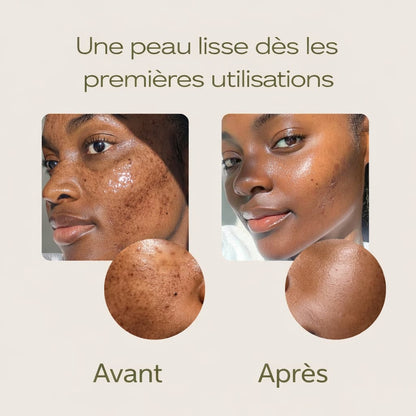 Peel Shot| Élimine les Impuretés et Sublime Votre Peau
