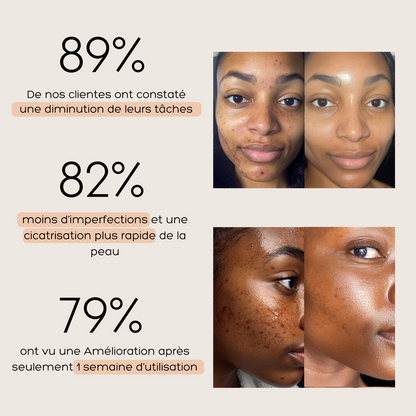 Routine Anti-imperfection 4 en 1