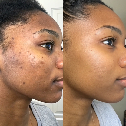 Crème hydratante au Curcuma