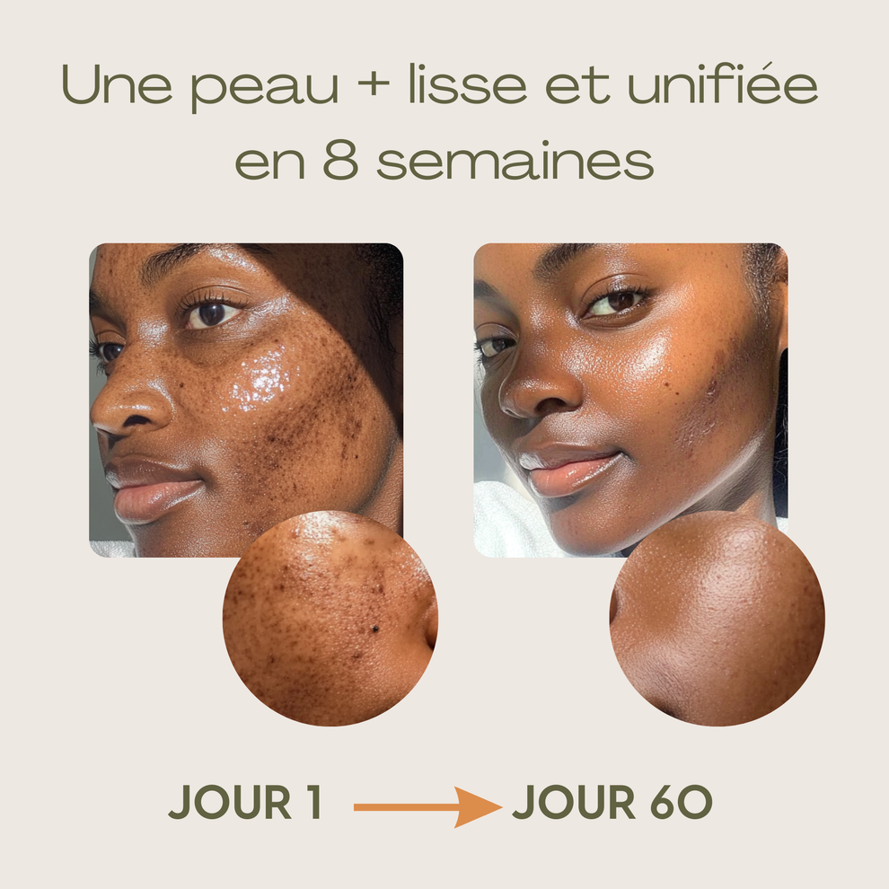 Routine Anti-imperfection 4 en 1
