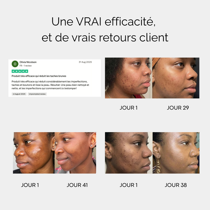 Routine Anti-imperfection