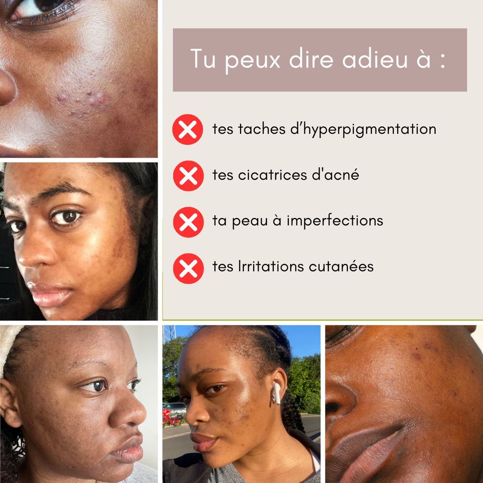 Crème hydratante au Curcuma