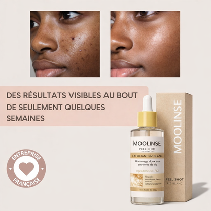 Peel Shot| Élimine les Impuretés et Sublime Votre Peau